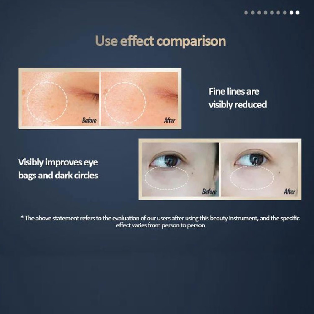 Multifunctional EMS RF Eye Skin Rejuvenation Beauty Device